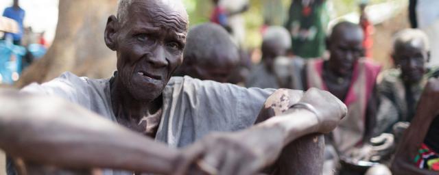Majok esperando la distribución de alimentos del Programa Mundial de Alimentos en Nyal. Ayudado por sus familiares, tuvo que caminar durante hora y media desde su casa para estar presente físicamente en el registro. Foto: Bruno Bierrenbach Feder/Oxfam
